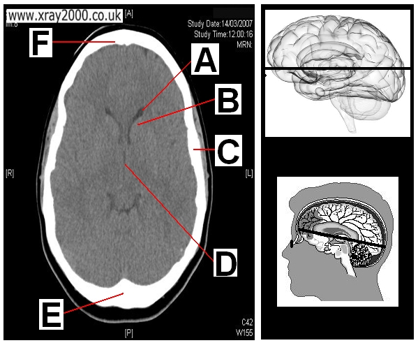 AXIAL SECTION 7.JPG